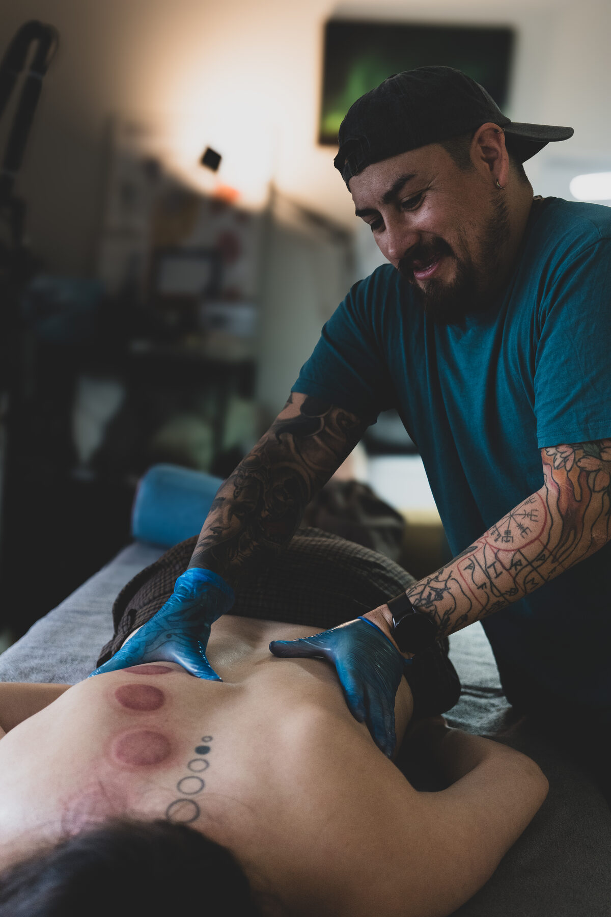 A massage therapist working on a client’s back after a cupping treatment